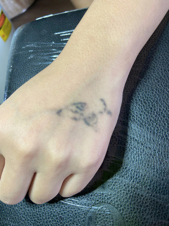 最新洗紋身技術(shù)及其觀點(diǎn)論述