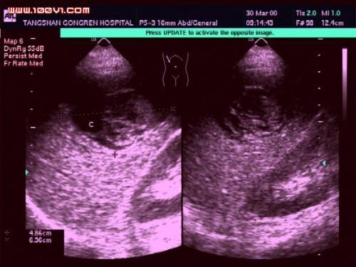 包蟲界的明星日常趣事揭秘